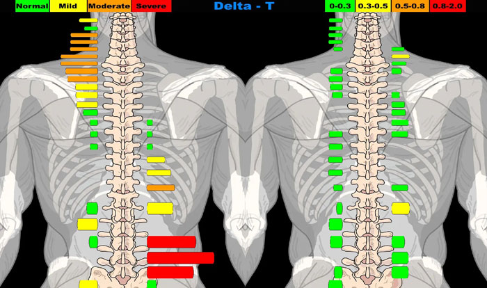 Children  Chiropractic in Naugatuck, registered chiropractors in CT in Naugatuck, greg rochio dr of chiropractic in Naugatuck
