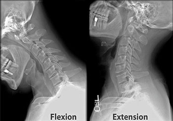 Naugatuck Family chiropractic services by dr Gret Rochio, Chiropractors in Naugatuck